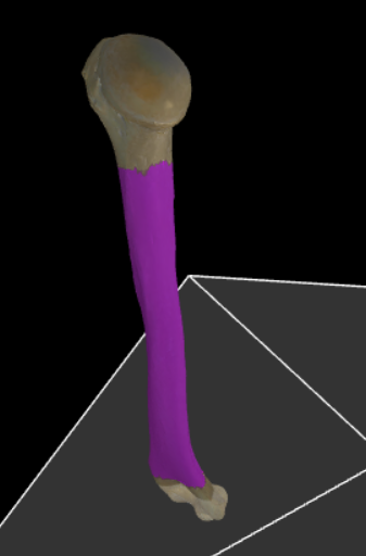 <p>Dit is de diafyse van de humerus.</p>