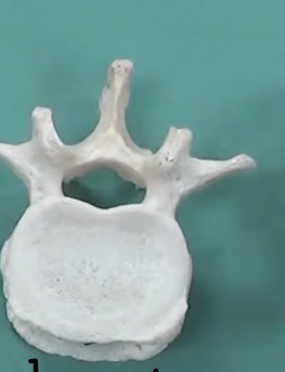 <p>What part of the vertebrae is this?</p>