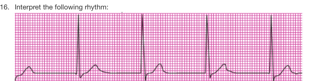 <p>interpret the rhythm</p>