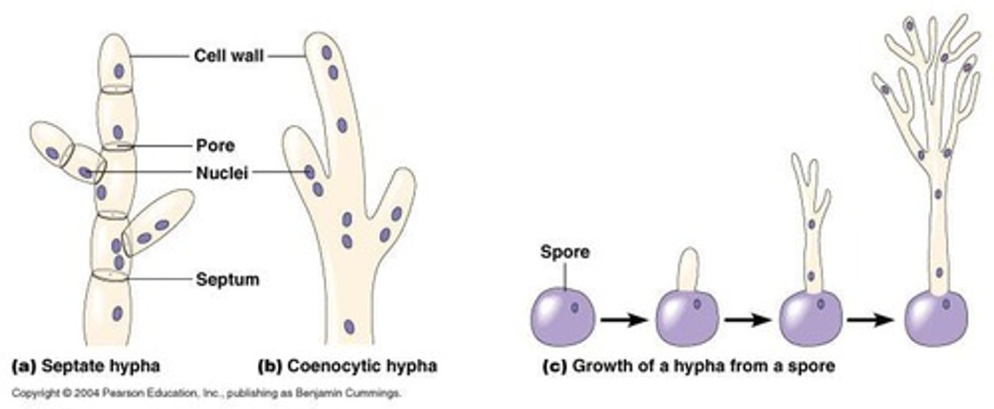 <p>Hyphae can be septate (with cell walls that separate hyphae) or coenocytic (without division of hyphae during cell division).</p>