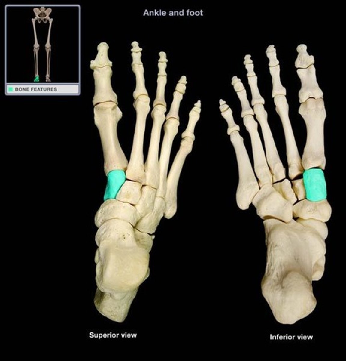 <p>What is the term of the bones highlighted in green?</p>