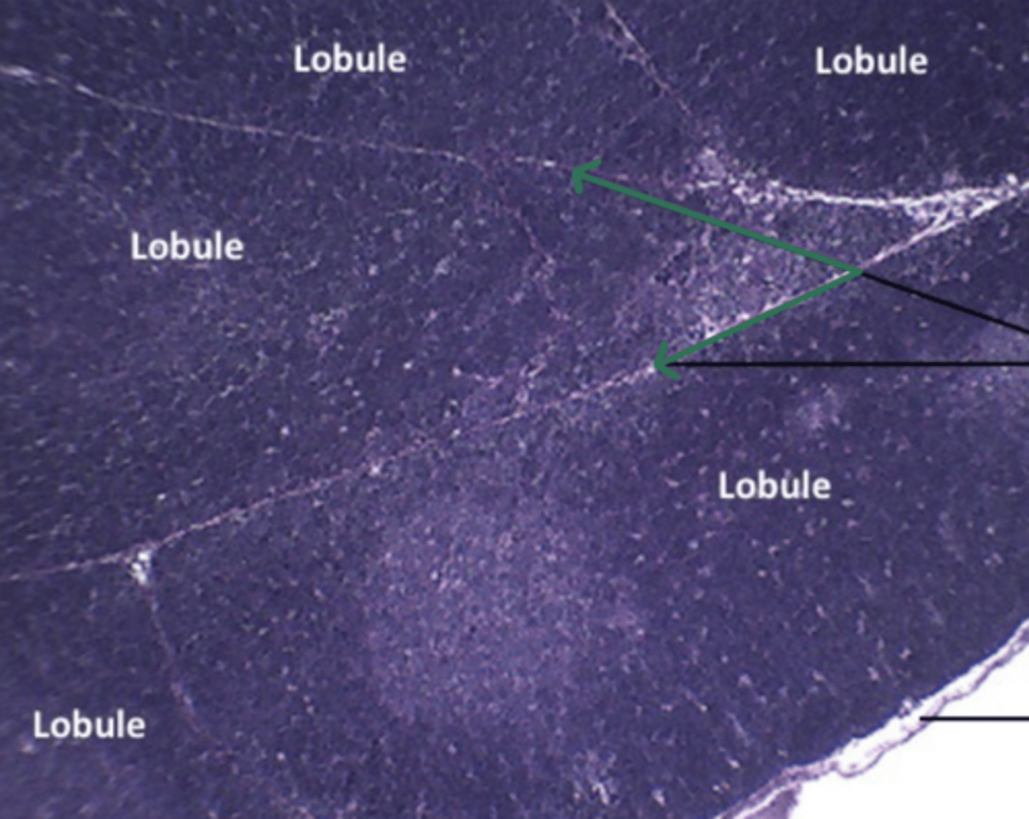 <p>gland and structure</p>