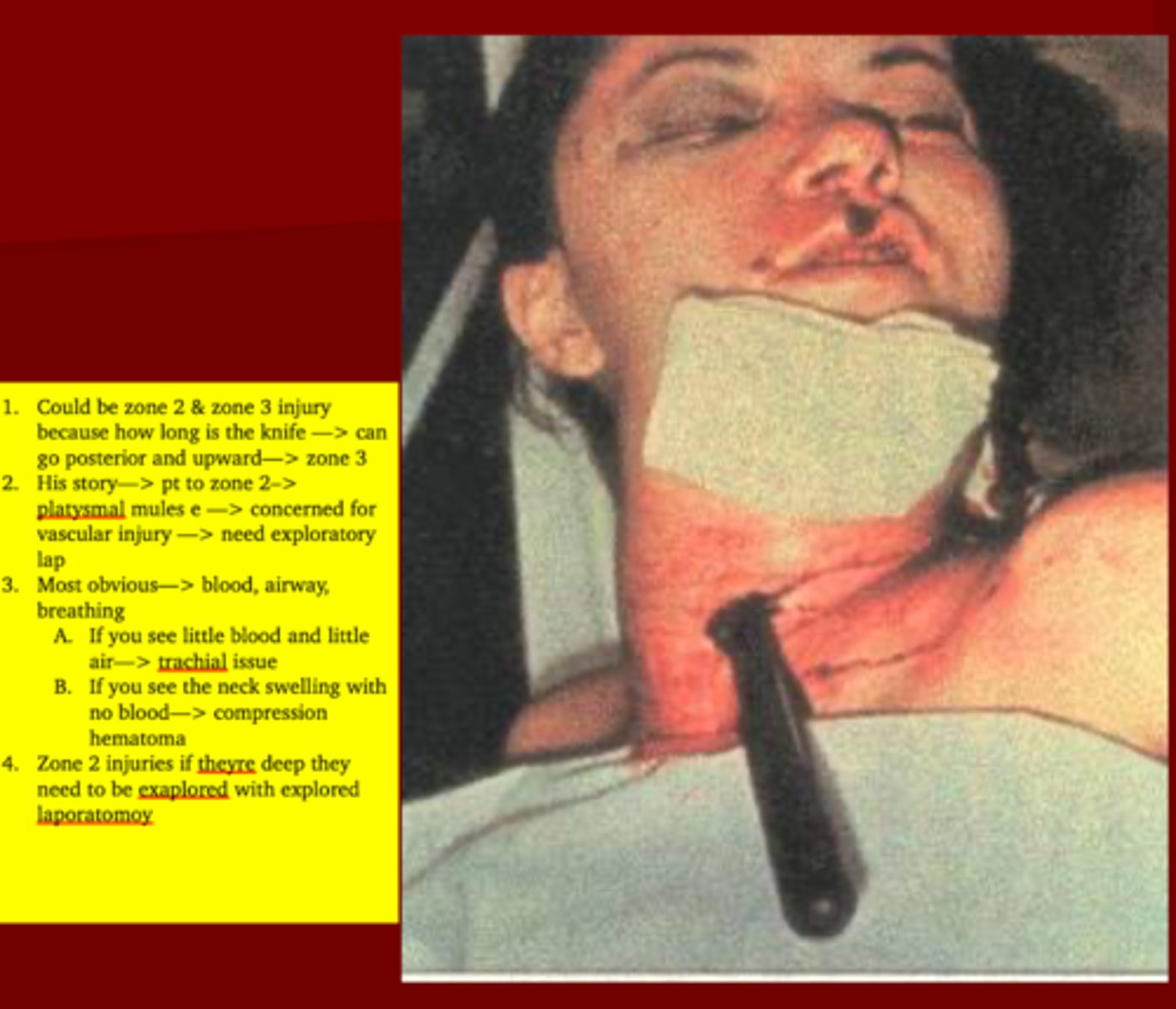 <p>1. Vascular injuries </p><p>2. Platysmal muscle </p><p>3. Exploratory Laparotomy </p>