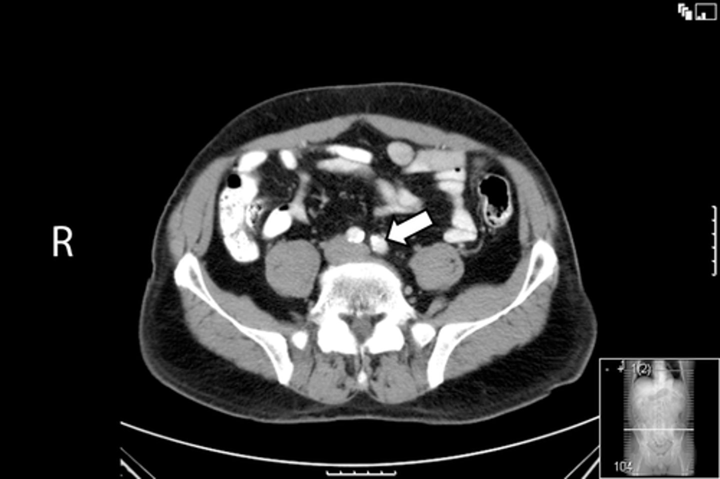 <p>What is indicated in the image?</p>