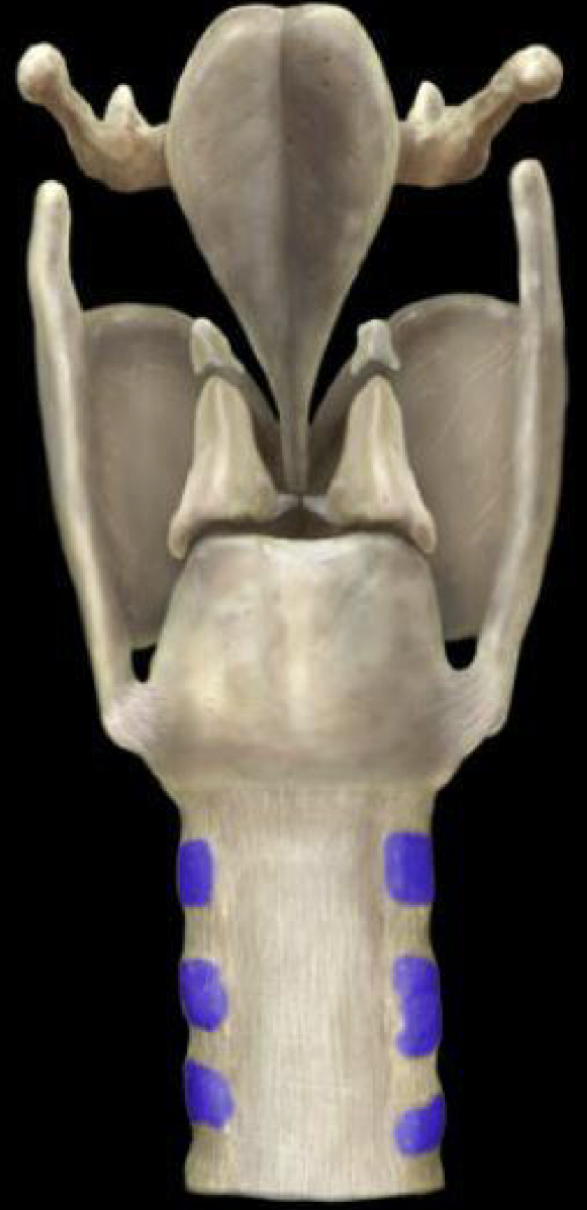 What structure is highlighted in blue?