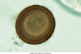 <p>This was found on the fecal float of a filly.</p>