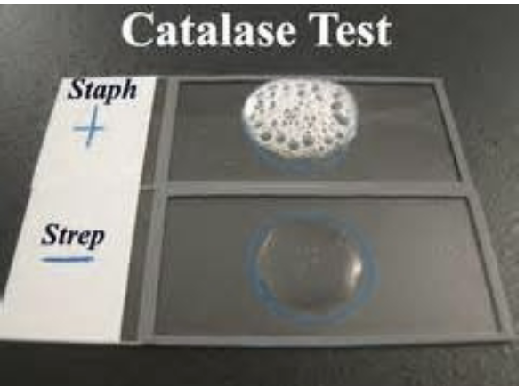 <ul><li><p><span>Gram+ cocci:&nbsp;</span>Staphylococci and Streptococci</p></li></ul><p></p>