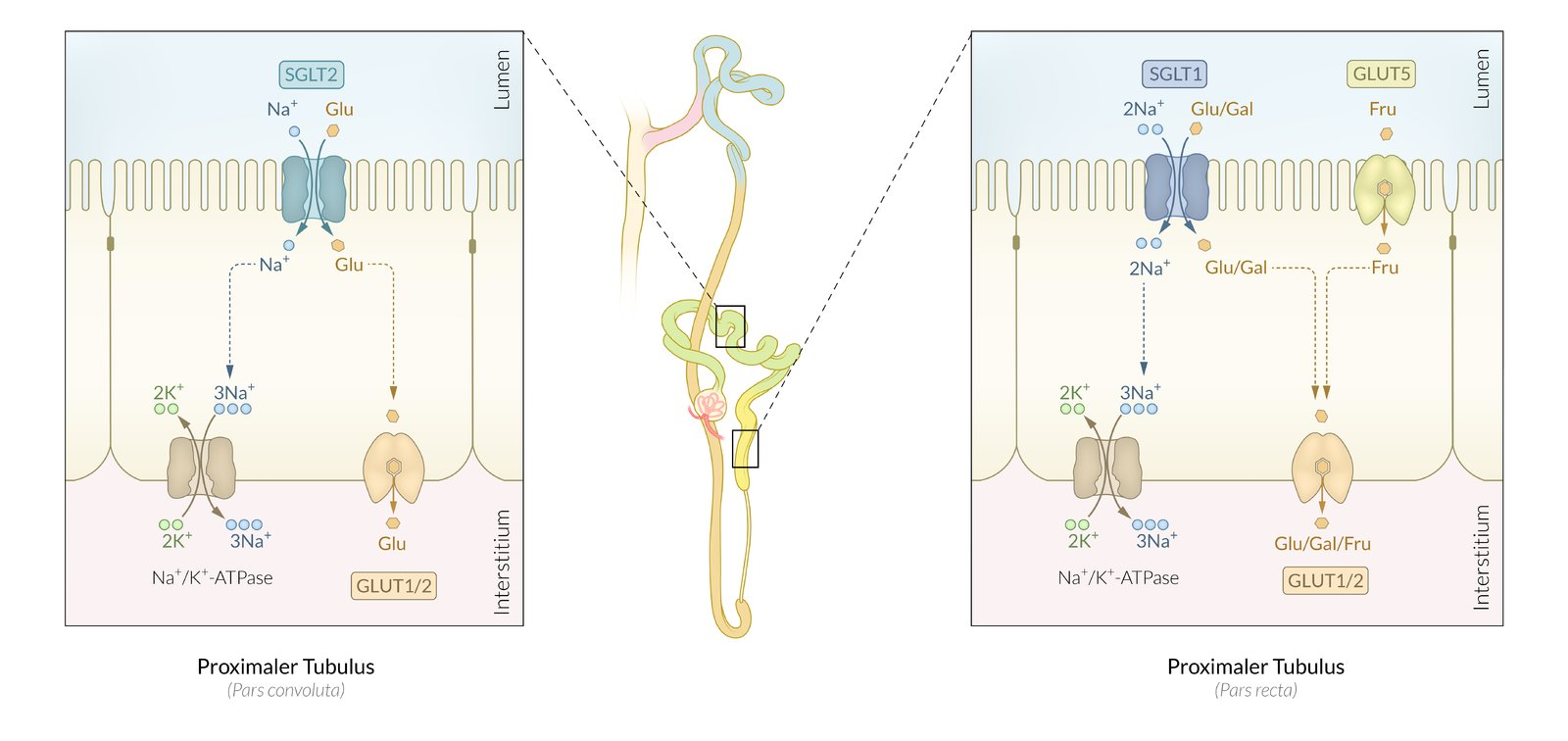 <p>D. Reduced function of the Na⁺/glucose symporter</p>