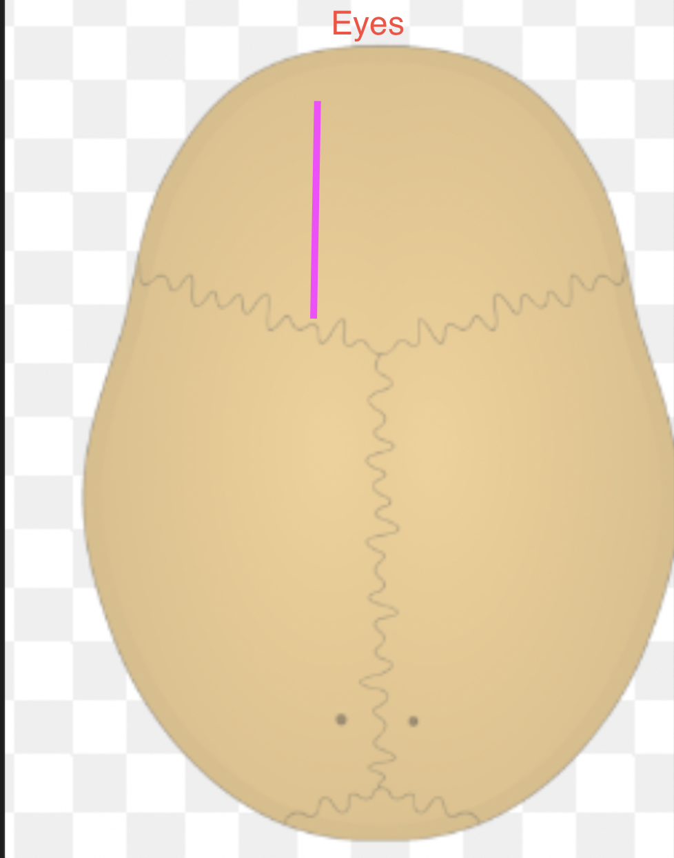 <p>What bone marking is this?</p>