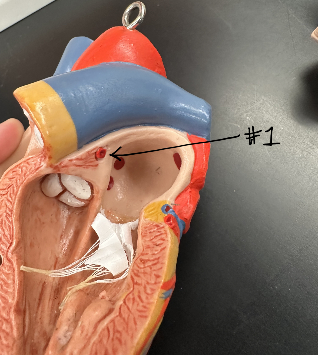 \#1 (branches off each side of the aorta)