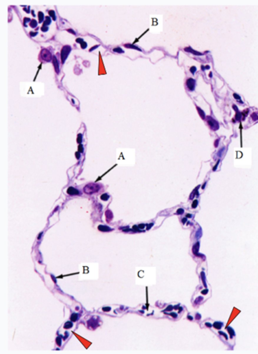 <p>ID the cells marked w/ the letter D:</p>