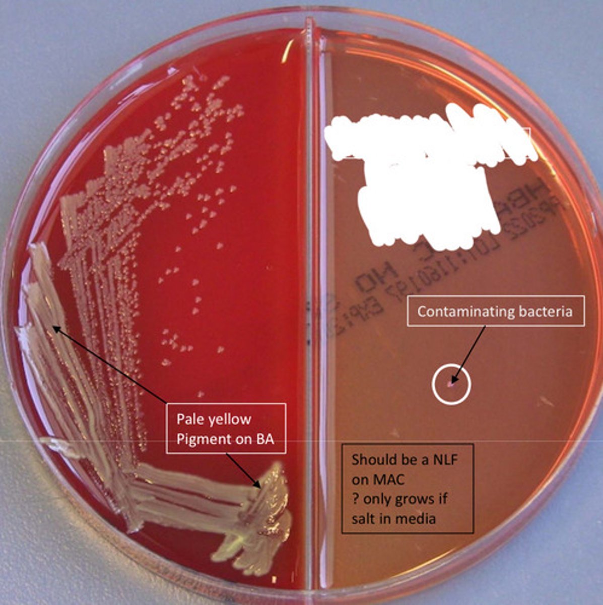 <p>GNB, oxidase pos, common in cystic fibrosis patients, spot indole neg, no growth on MAC</p>