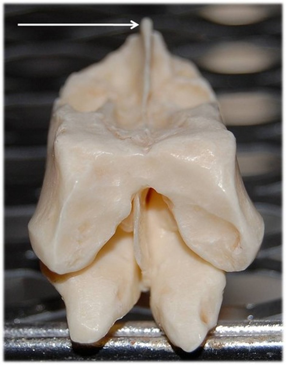<p>ethmoid bone - "rooster's comb" sticks up into cranial cavity</p>