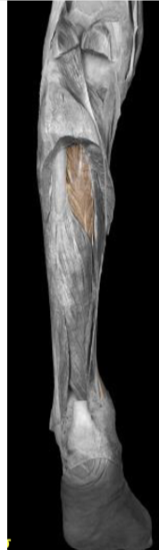 <p>tibialis posterior</p>