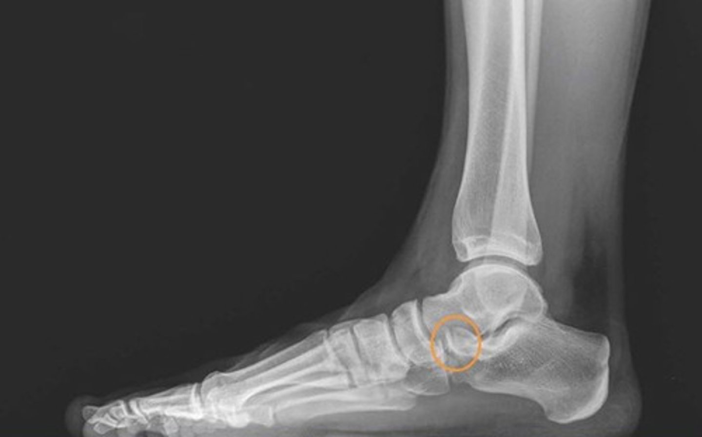 <p>lateral</p><p>3 multiple choice options</p>