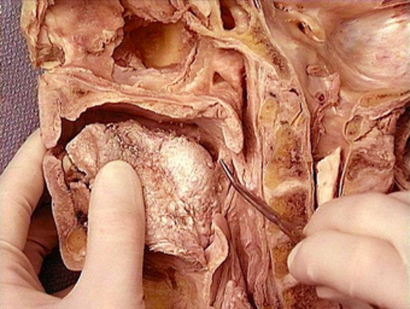 <p><em>identify the structure:</em></p>