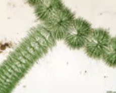 <p>each branch a single file of cells; Batrachospermum turfosum</p>