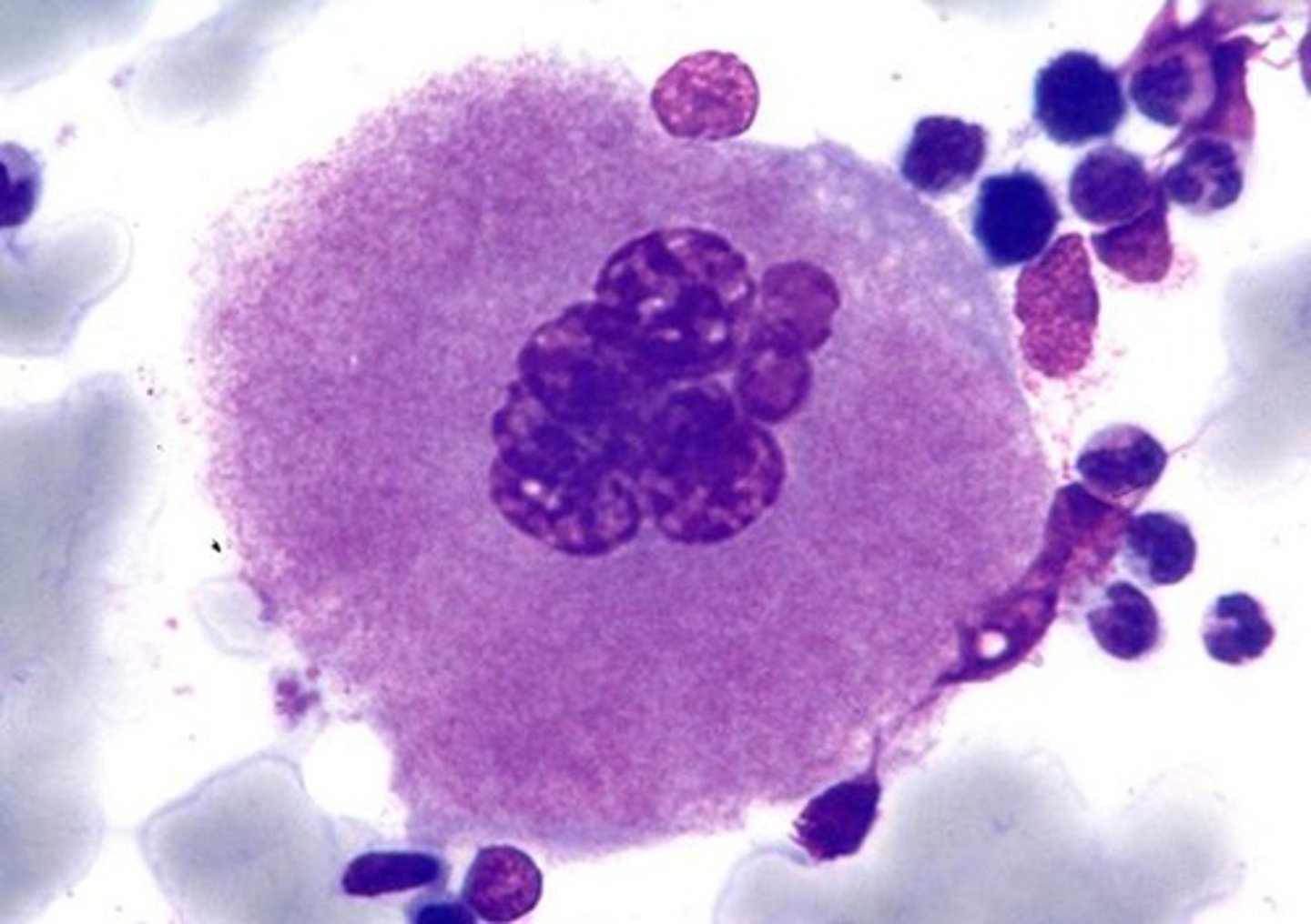 <p>Last stage of thrombopoiesis. These cells have several nuclear lobes and a cytoplasm with reddish granules. Cytoplasm is sheared off by bone marrow sinuses to become platelets</p>