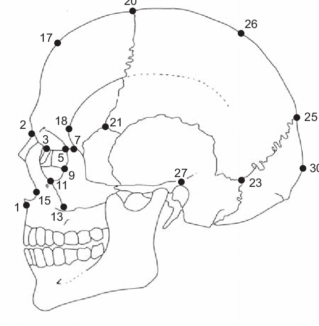 <p>greatest cranial width, along temporal line between 26 and 27</p>