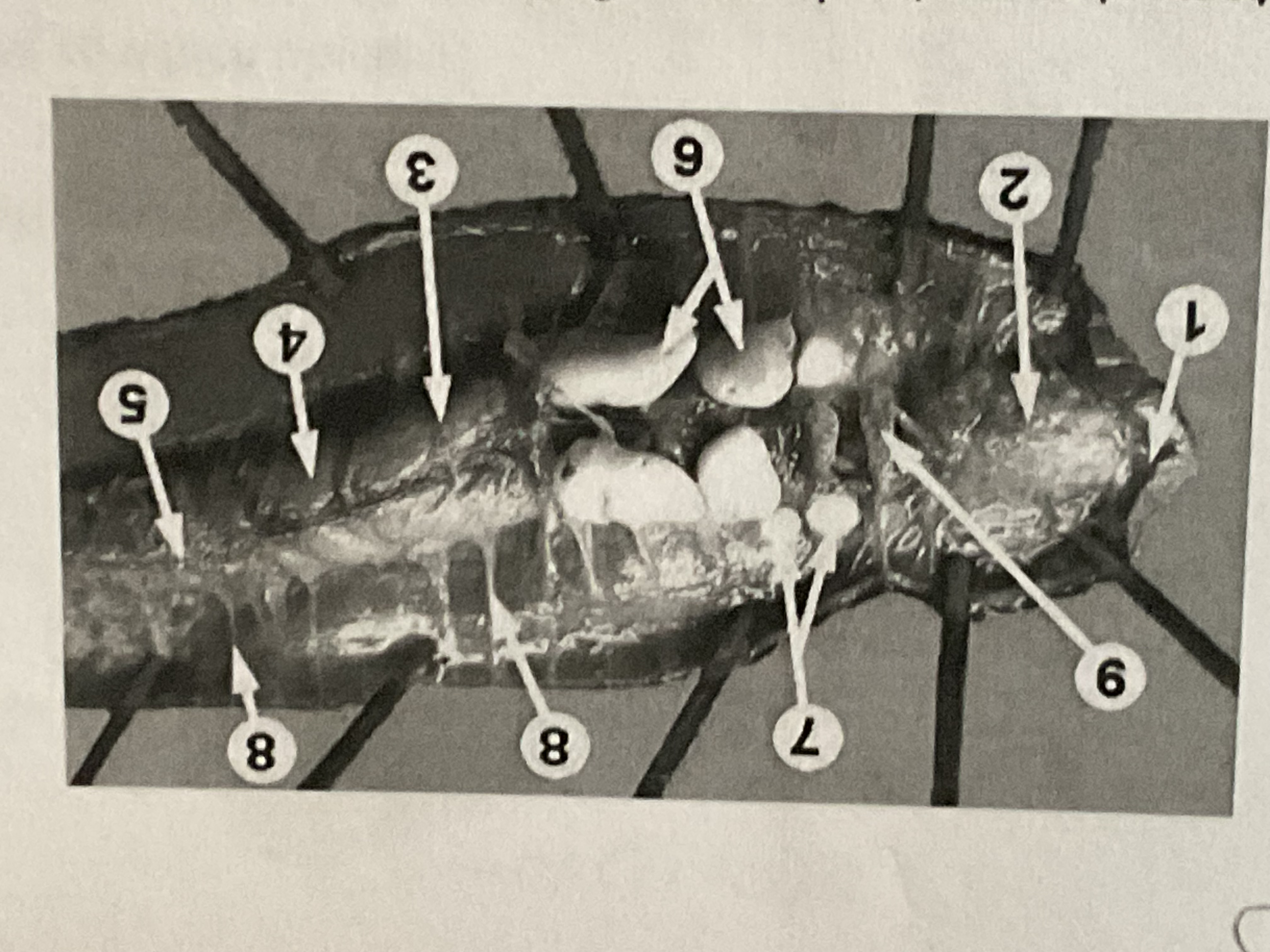 <p>Which organ labeled 2 below? This passageway lies between the mouth and esophagus </p>