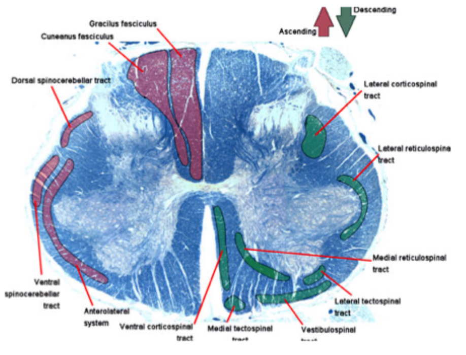 <p>A tract is a<strong> chain</strong> of<strong> two</strong> or <strong>three</strong> neurons</p><ul><li><p>sensory comes in through DR, synapses in GM and then axon leaves and ascends through brain&nbsp;</p></li></ul><p></p><p><strong>No!</strong> Some tracts stay on the same side, but most cross over at some point in the pathway</p><ul><li><p>All pathways are paired too; one tract on left and right sides of SC</p></li></ul><p></p><p></p>