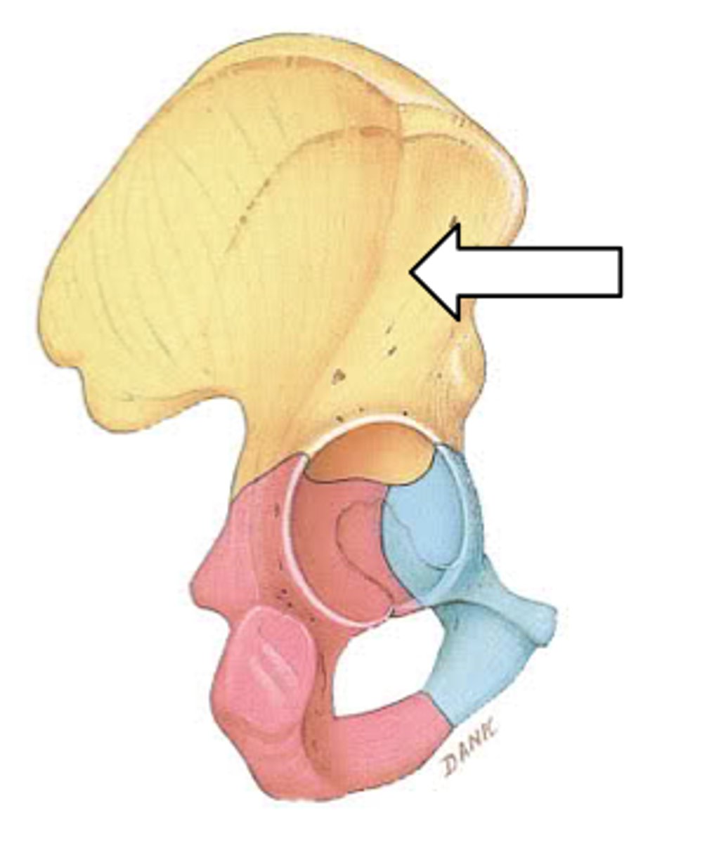 <p>ID bone</p>
