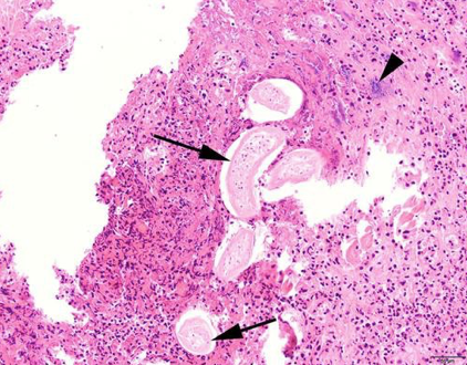 <p>This histology slide contains which equine parasite?</p>