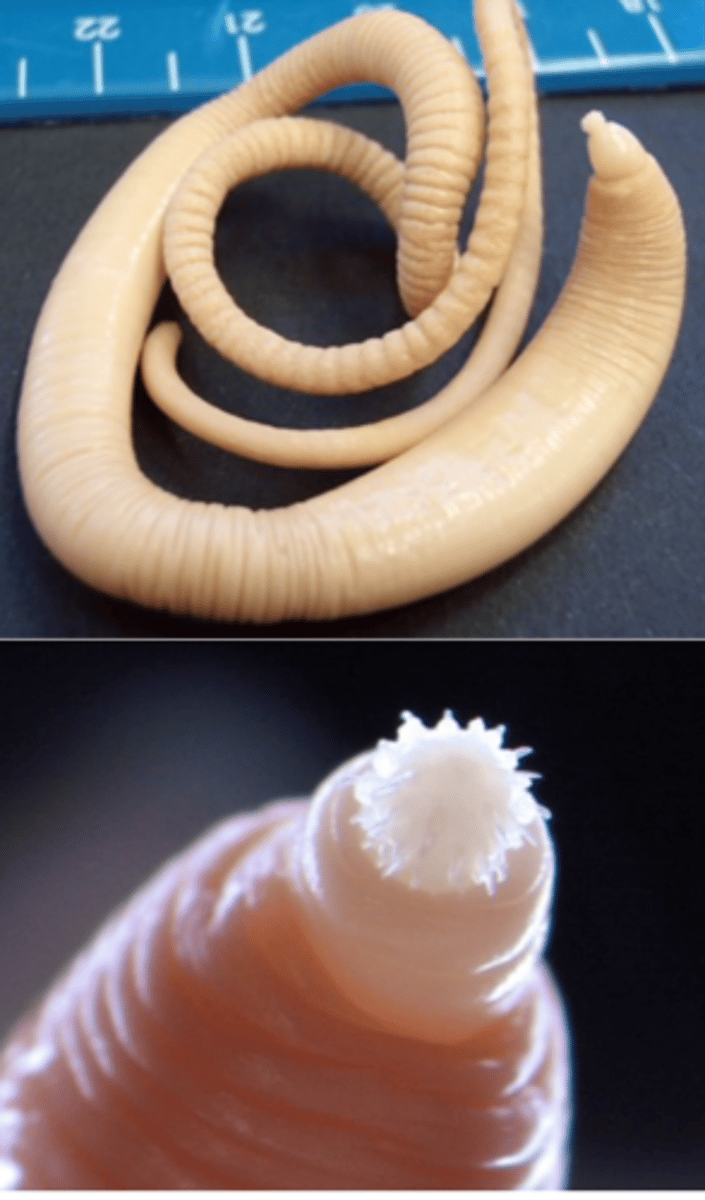 <p>Location: small intestine of pigs (humans): a nodule is often present at the point of attachment to the small intestine;</p><p>Morphology (adult worms);</p><p>Size: up to 35 cm;</p><p>Proboscis provided with around 6 transverse rows of hooks;</p><p>Intermediate hosts: May beetles, dung beetles, water beetles</p><p>Nodular lesions that might be invaded by bacteria;</p><p>Perforation of the gut  peritonitis;</p><p>Diarrhoea, weight loss etc;</p><p>Diagnosis</p><p>• Detection of eggs in the faece</p><p>Treatment</p><p>Ivermectin </p><p>Doramectin</p>