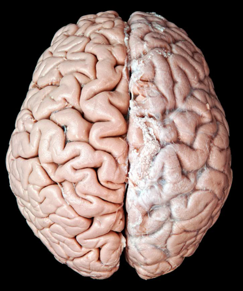 <p>pia mater</p>