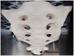 Name this specific bone.