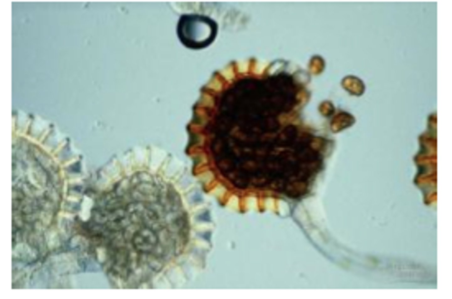 <p>(large sac-like structure) - a closed sac-like structure where sporangiospores are formed. 725</p>