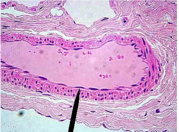 <p>simple squamous epithelial tissue</p>