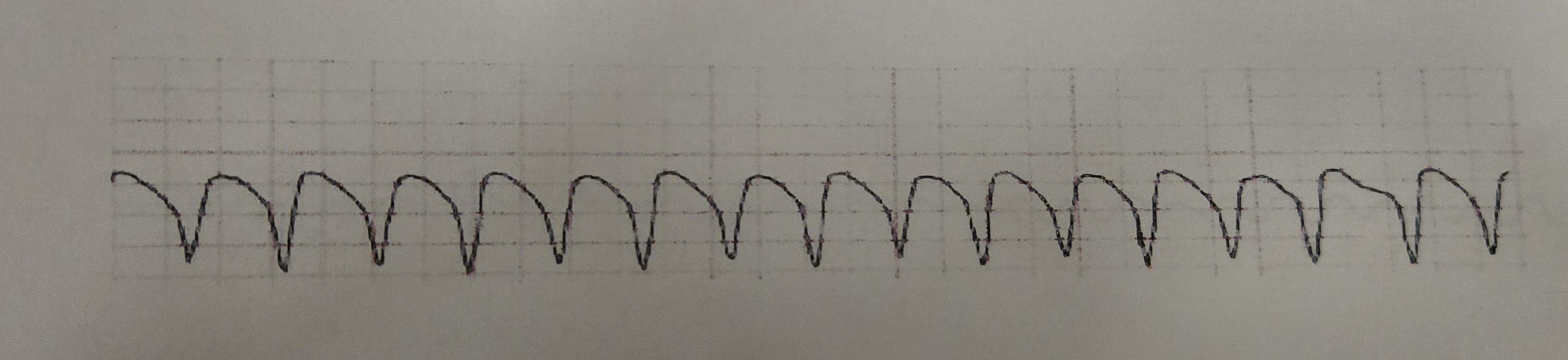 <p>What Rhythm is this?&nbsp;</p>