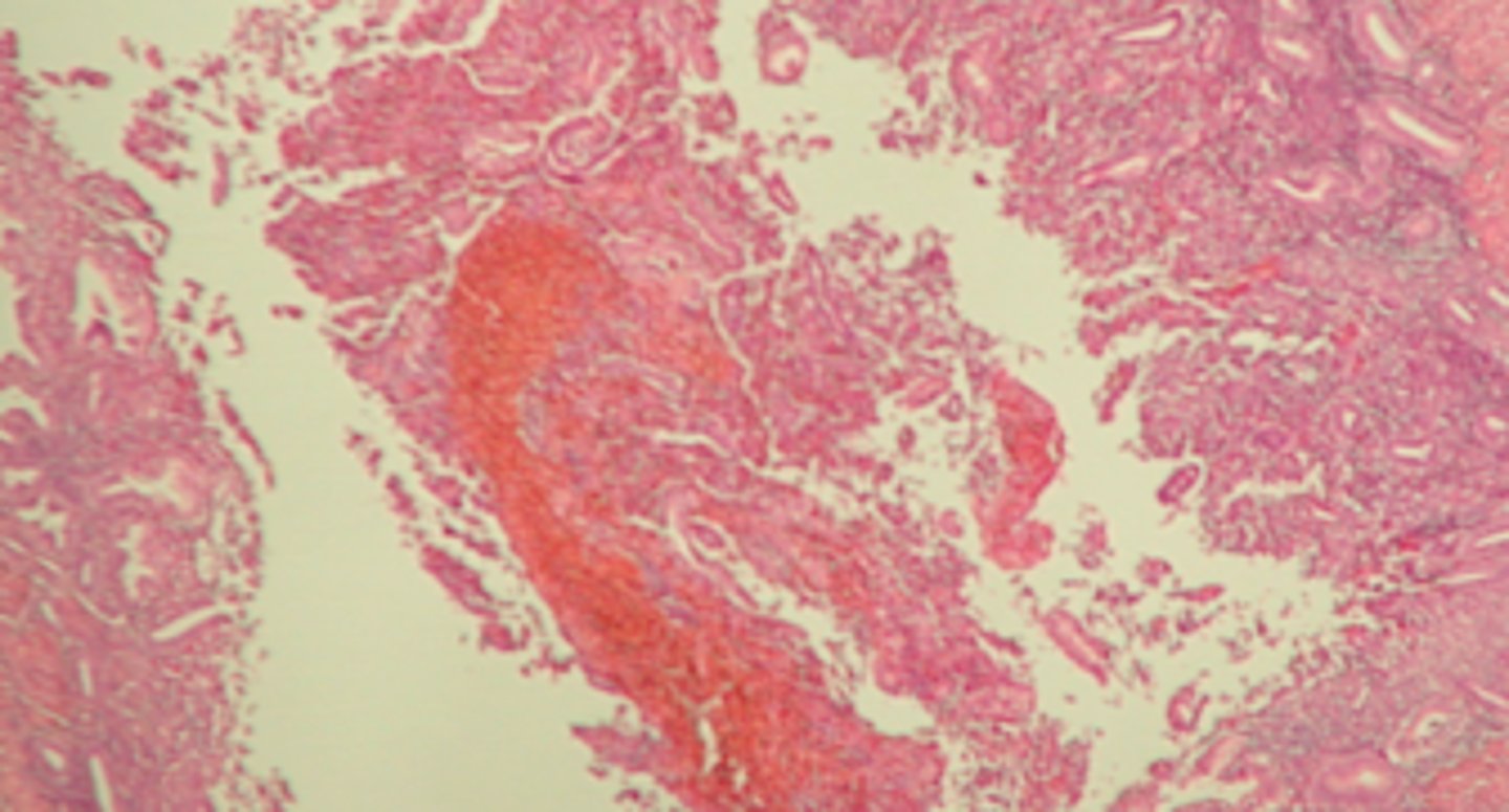 <p>The red portion - white portions are the uterine cavity</p>