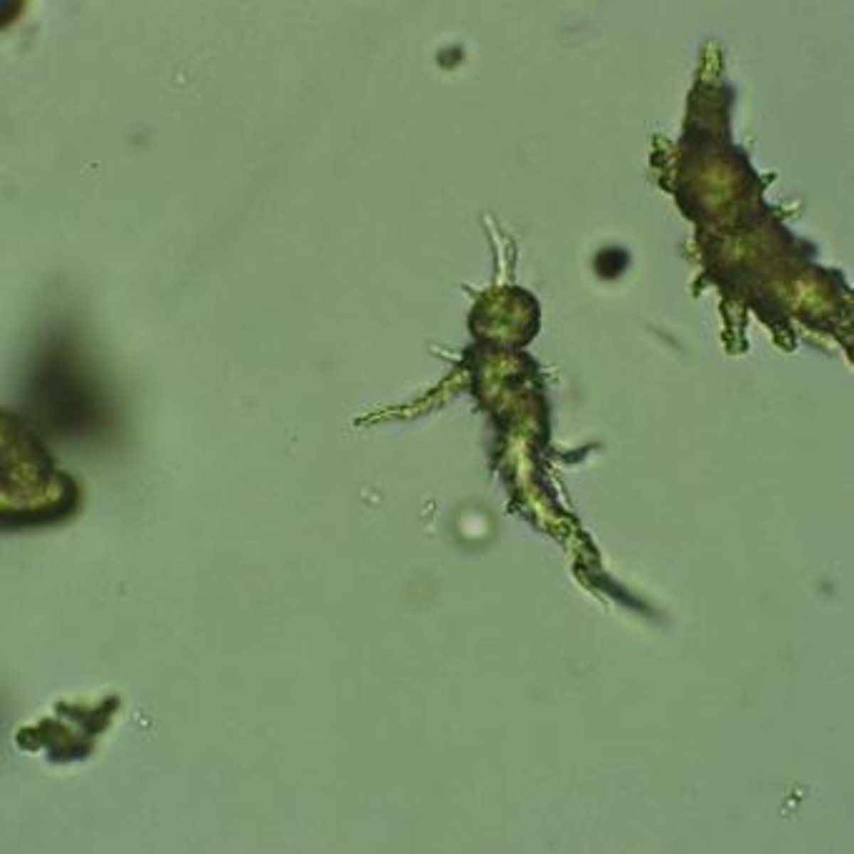 <p>May be rods or cocci, present with WBCs in UTI, observed under Brightfield at 40x.</p>