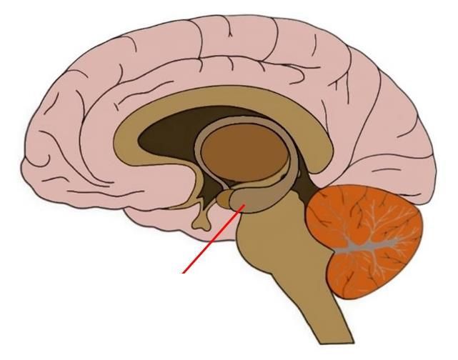 gray matter deep in the temporal lobe that is very important for long-term memory formation