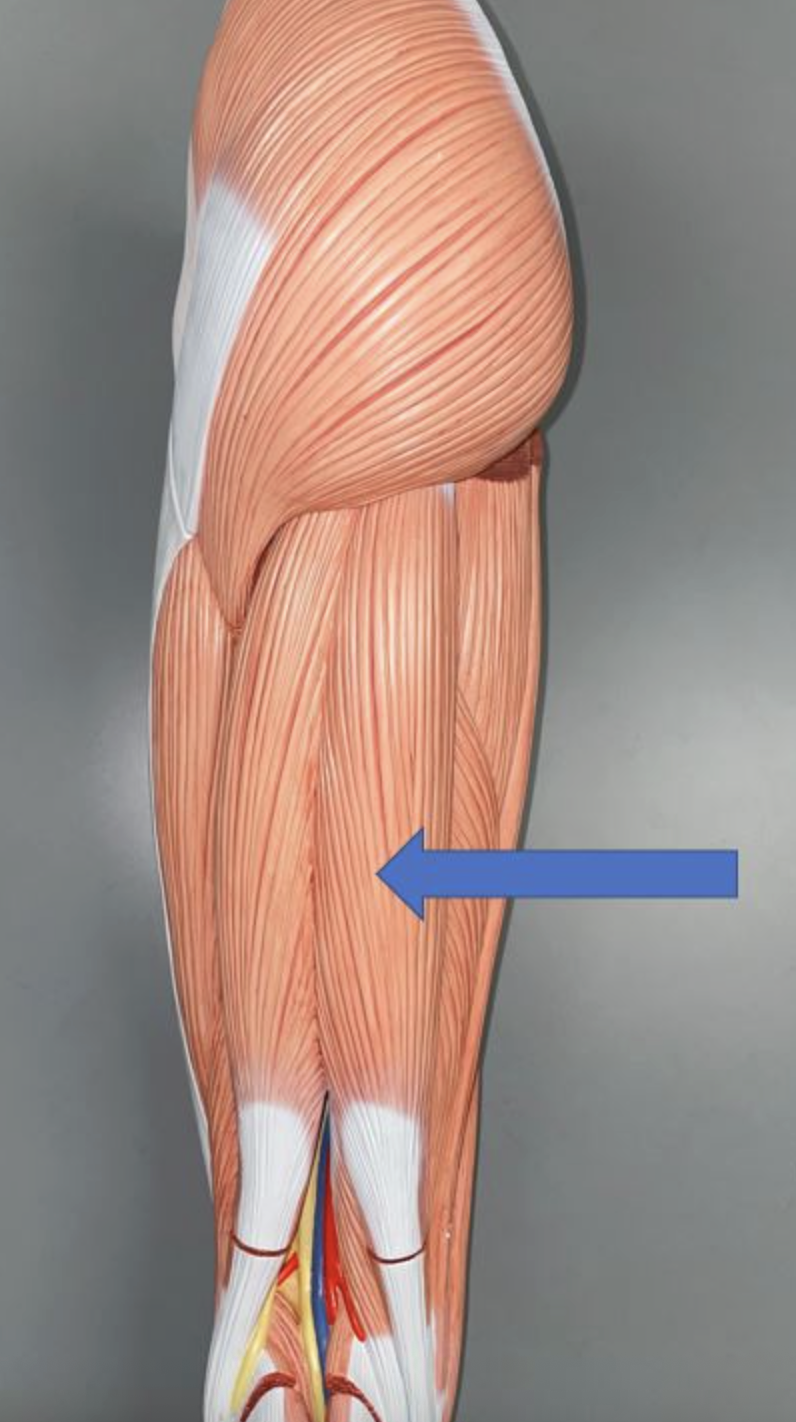 <p>muscle name &amp; action</p>