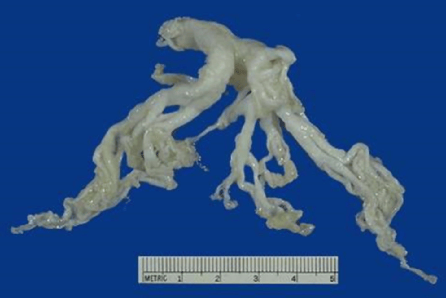 <p>What is depicted here?</p>