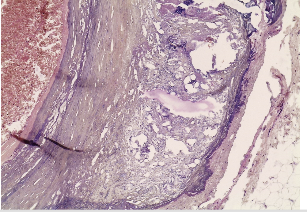 <p>Welk preparaat</p>