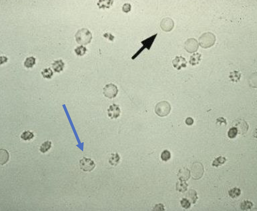 <p><span style="color: #000000">What is the </span><span style="color: #000000">black</span><span style="color: #000000"> arrow pointing to?</span></p><p><span style="color: #000000">What is the </span><span style="color: #000000">blue</span><span style="color: #000000"> arrow pointing to?</span></p><p><span style="color: #000000">Based on the blue arrow </span><span style="color: #000000">what type of solution is this</span><span style="color: #000000">?</span></p>