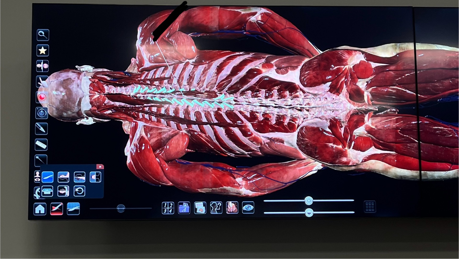 <p>What spinal muscle is this</p>