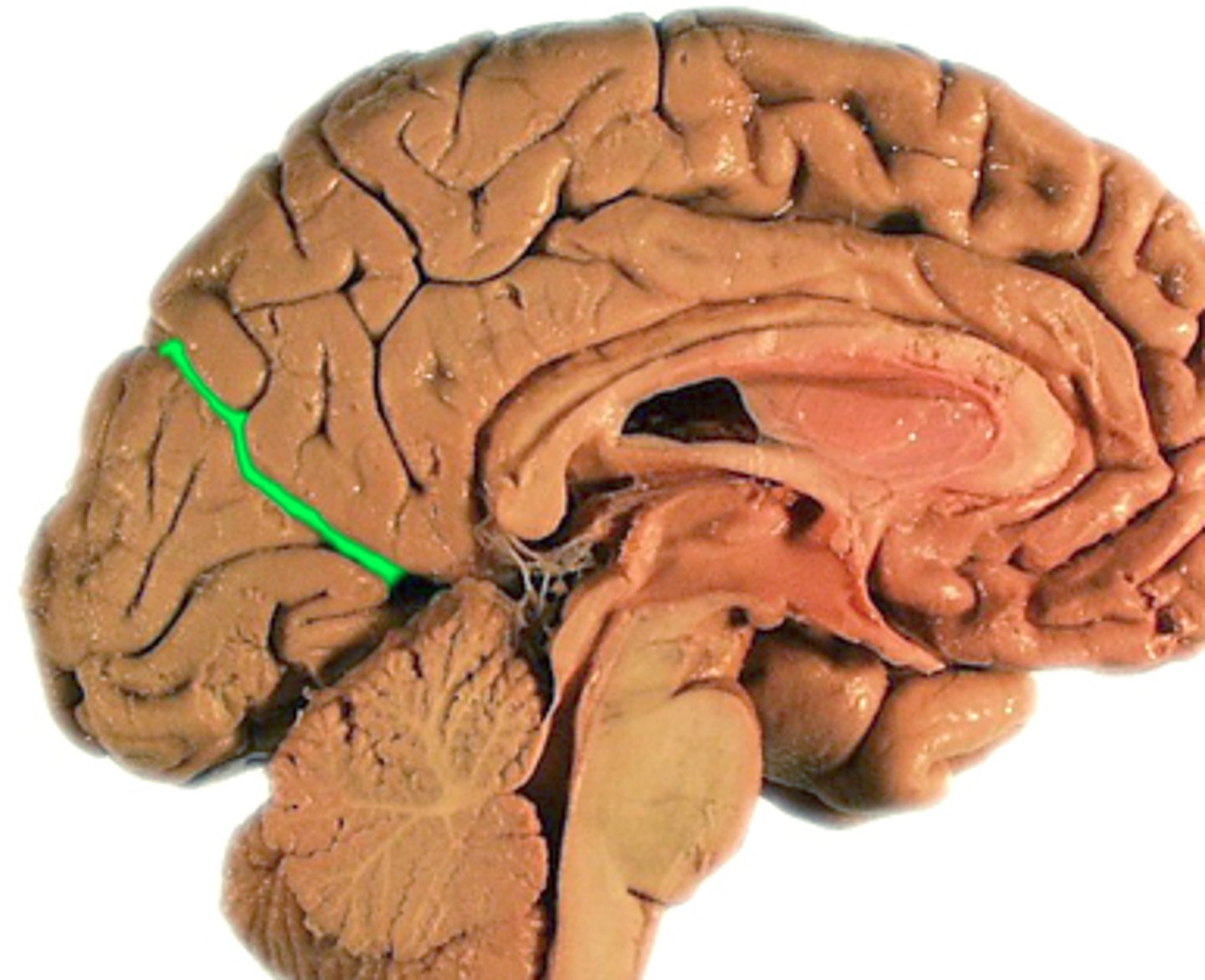 <p>separates parietal and occipital lobes</p>