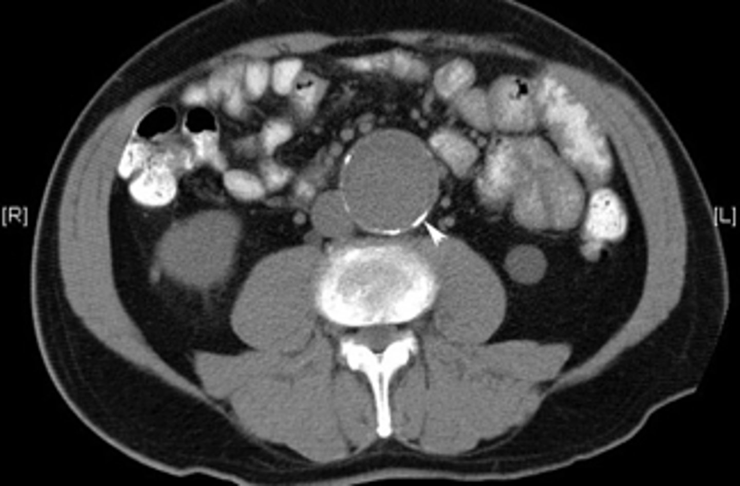 <p><em>identify the pathology</em> </p>