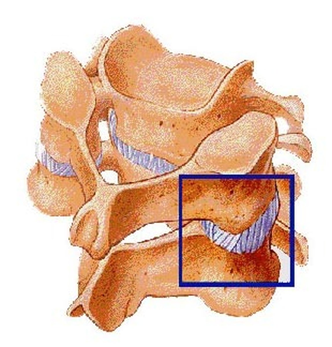 <p>Pars Interarticularis</p>