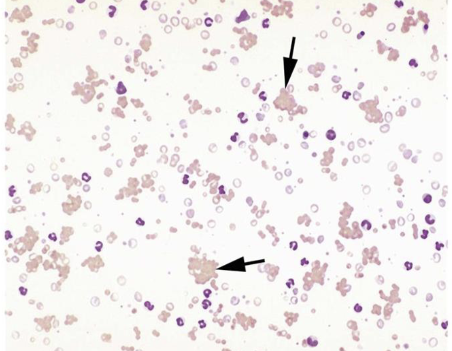 <p>what type of RBC arrangement is this</p>