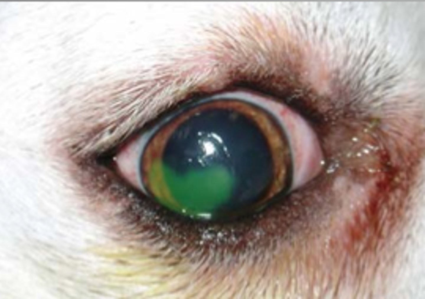 <p>Full-thickness loss of corneal epithelium, exposing underlying stroma layer.</p>