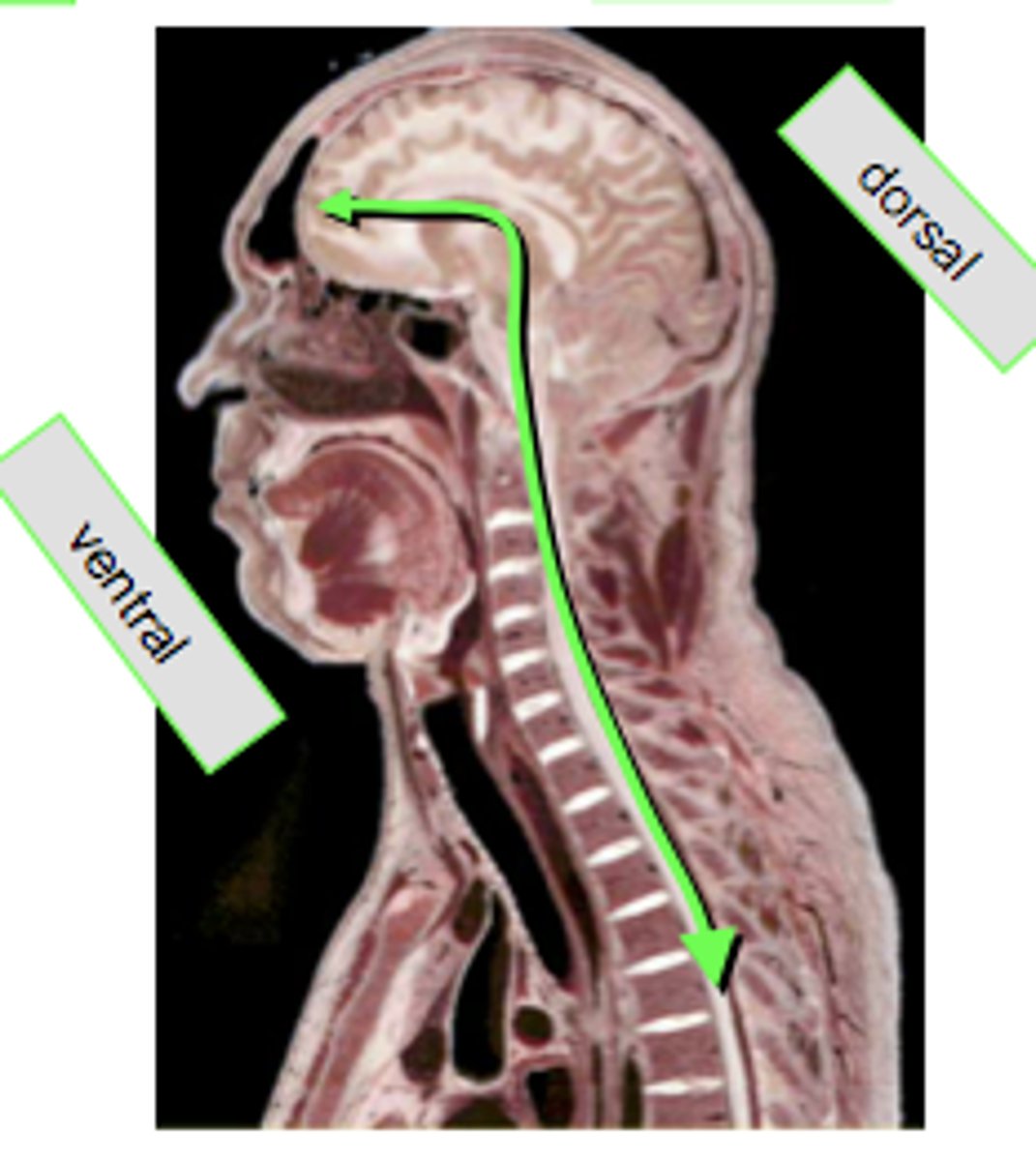 <p>- An imaginary line that shows the direction in which the central nervous system lies</p><p>- Thought to bend by 90 degrees</p>