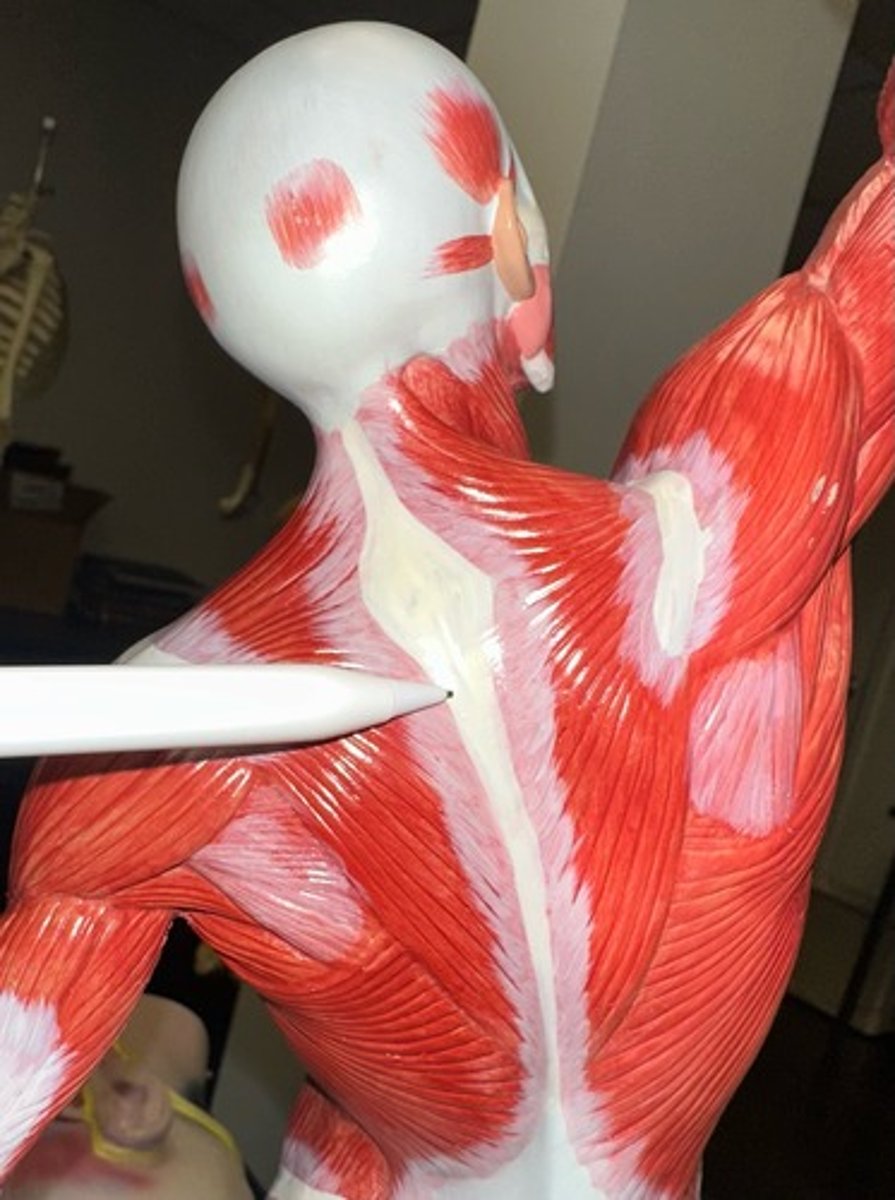 <p>What is this ligament called and what muscle attaches here?</p>