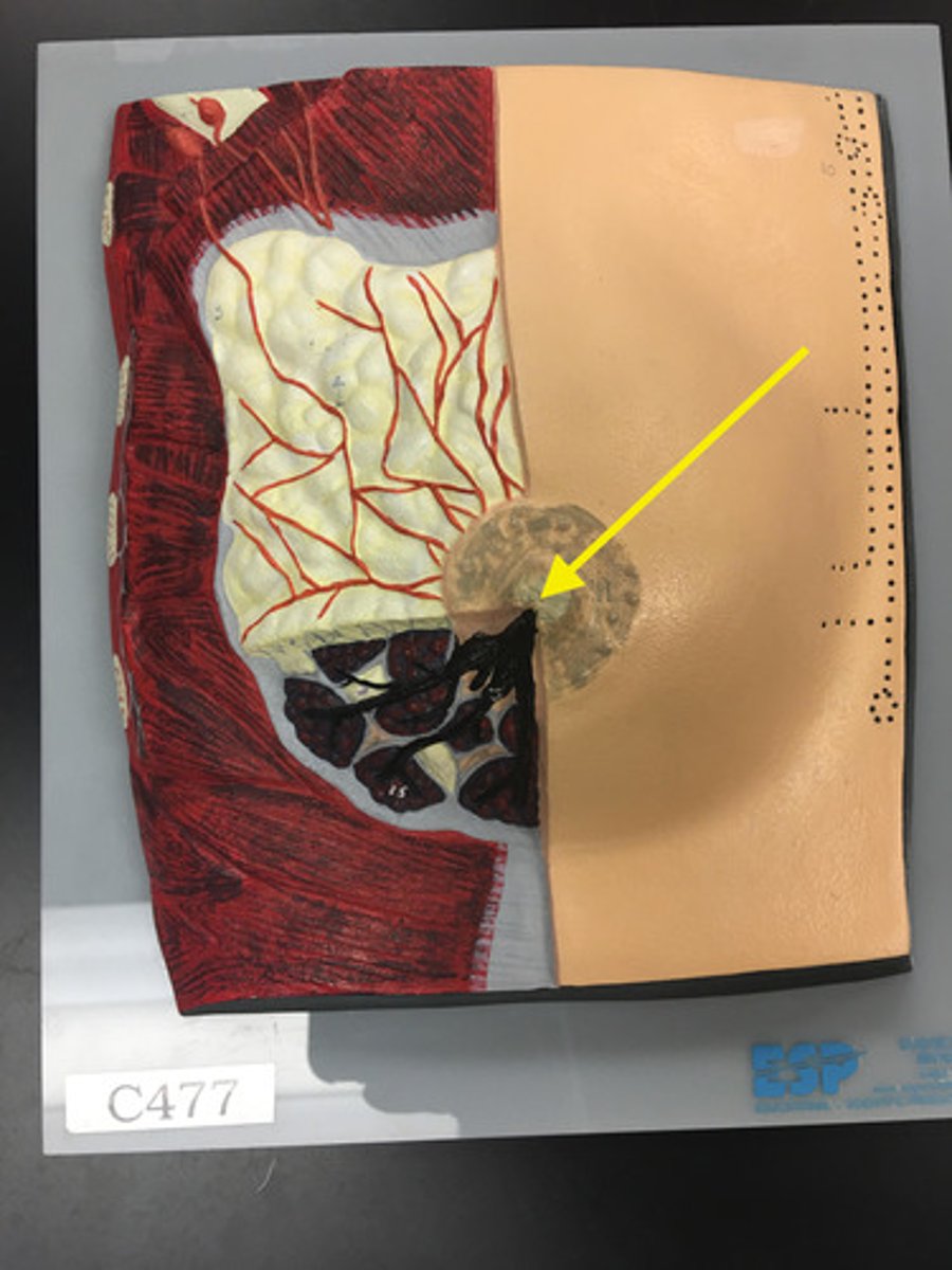 <p>Projection on the breast through which milk is released.</p>