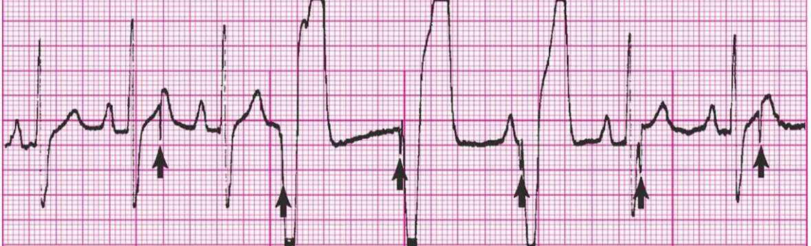 <p>What’s the rhythm?</p>